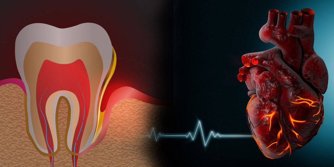 More Than a Toothache More Than a Toothache