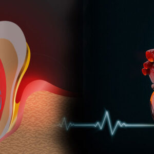 More Than a Toothache More Than a Toothache