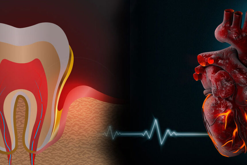 More Than a Toothache: How Your Gum Health Affects Your Heart and Sugar Levels